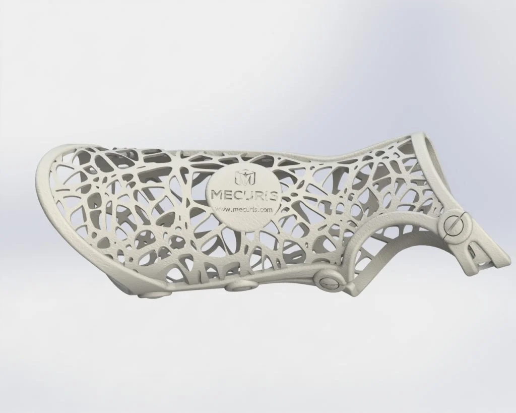 Mecuris Improves Orthopedic Care with SOLIDWORKS and Additive Manufacturing